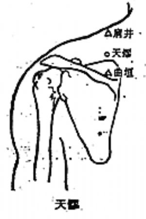 天髎穴的位置